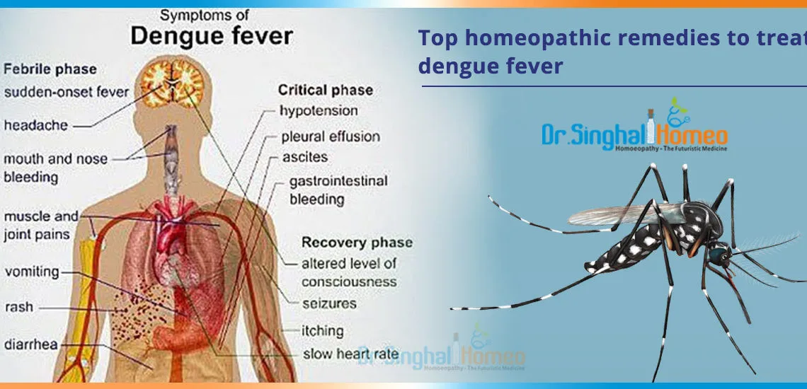 Top-homeopathic-remedies-to-treat-dengue-fever2